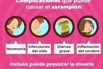 Michoacán, libre de casos de sarampión autóctono desde 1995: SSM