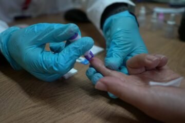 Realiza SSM detección oportuna de hepatitis C