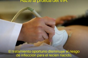 Realizadas más de 46 mil pruebas rápidas de VIH, en lo que va del año: SSM