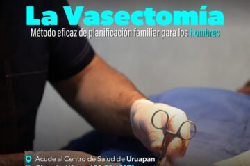 SSM realizará vasectomías sin bisturí en Uruapan SSM realizará vasectomías sin bisturí en Uruapan